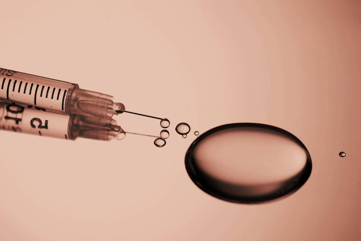 featured image for how long do hyaluronic acid fillers last