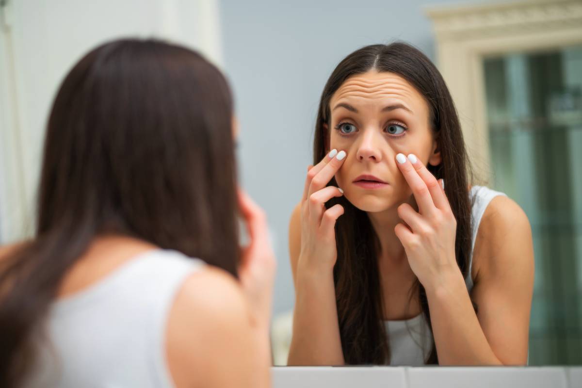 Featured image for How to Get Rid of Dark Circles